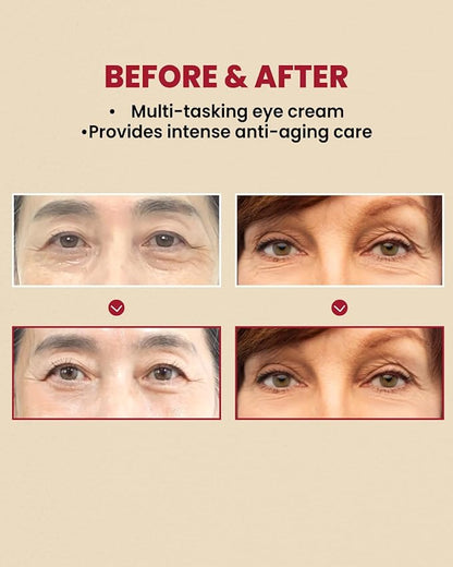 K-SECRET Crema Para Ojos Ksecret Seoul 1988: Liposoma De Retina Al 4% + Frijol Fermentado