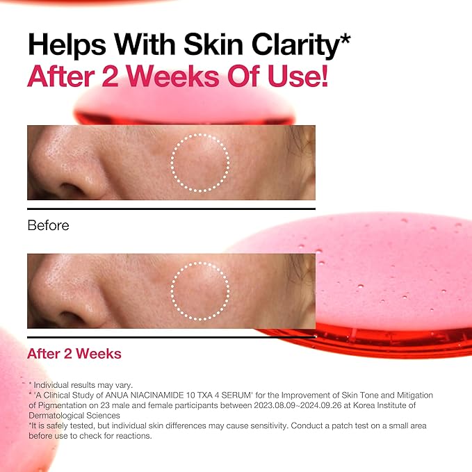 Lingtoolator Spot Correcting Serum / 10% Niacinamide+ 4% Tranexamic Acid, for Post-Acne Marks, Acne Scars, Hyperpigmentation and Even Skin Tone, Fragrance-Free