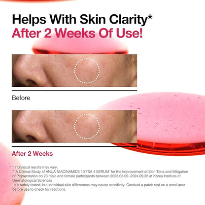 Lingtoolator Spot Correcting Serum / 10% Niacinamide+ 4% Tranexamic Acid, for Post-Acne Marks, Acne Scars, Hyperpigmentation and Even Skin Tone, Fragrance-Free