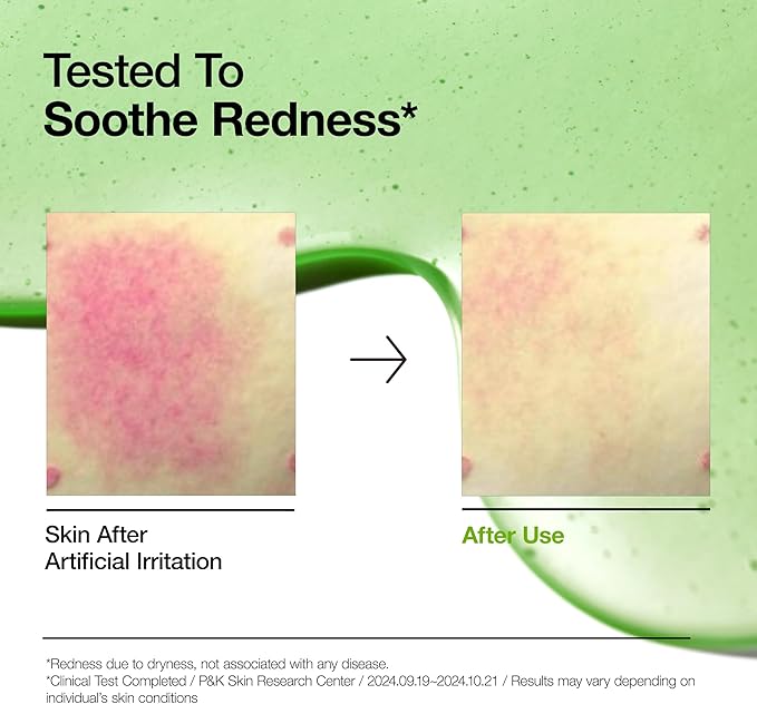 Anua Suero Facial Calmante con Acido Azelaico 10% y Acido Hialuronico, para Piel Sensible