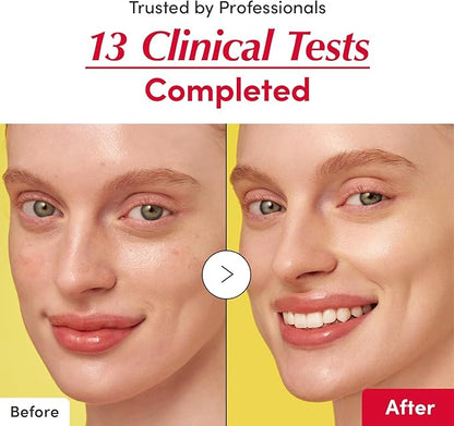 EQQUALBERRY "EQQUALBERRY Suero iluminador con vitamina C: suero iluminador con acerola y niacinamida, Fortalece la barrera cutánea, Hidrata con ceramida y ácido hialurónico